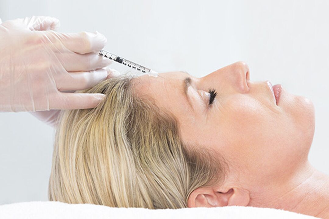 Плазмолифтингът е инжекционен метод за подмладяване на кожата на лицето