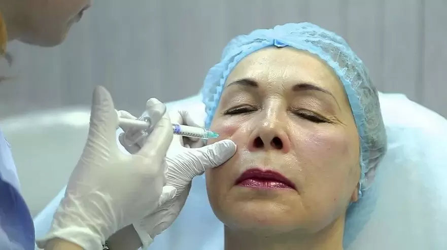 биоармиране за подмладяване на лицето